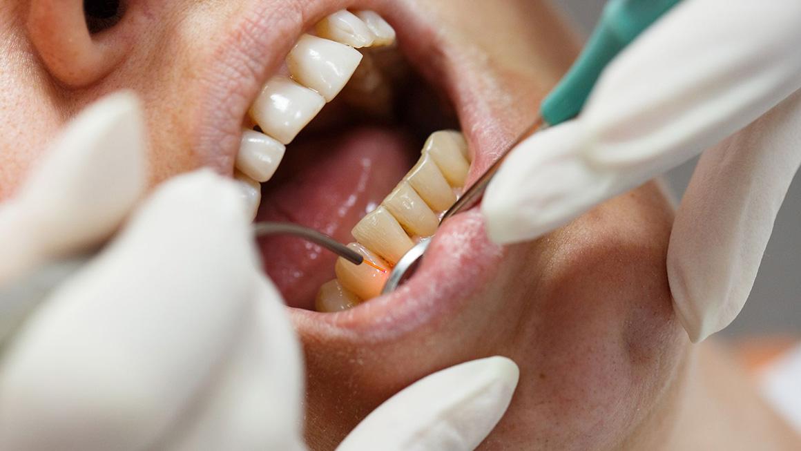 Laseranwendungen in der Zahnheilkunde